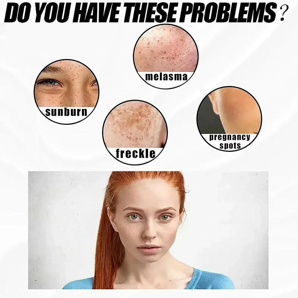 Eelhoe Niacinamide Brightening Cream