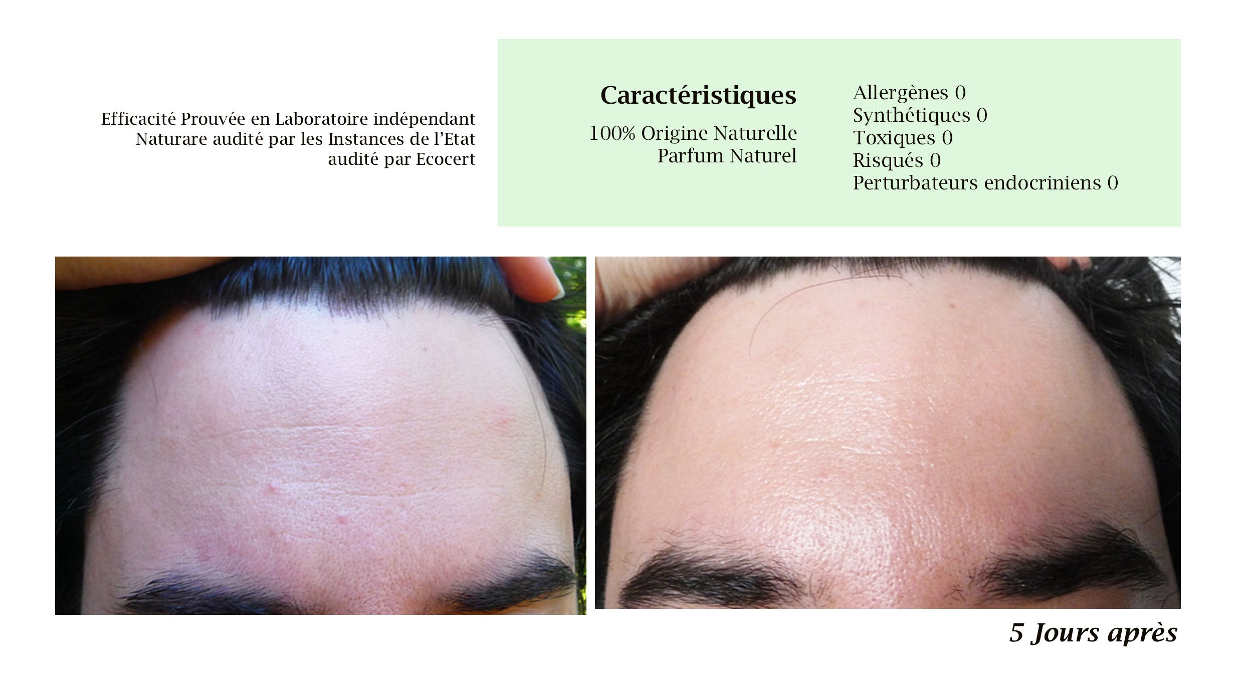 PRO - MERVEILLE DES LANDES ORGANIC - Sensitive Skin Care Complete Regeneration