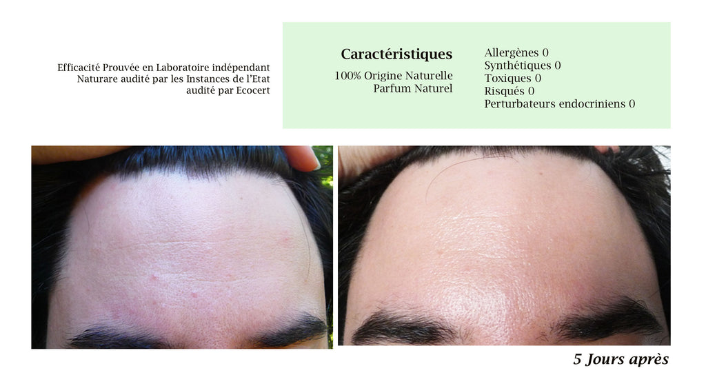 DROP - MERVEILLE DES LANDES ORGANIC - Sensitive Skin Care Complete Regeneration