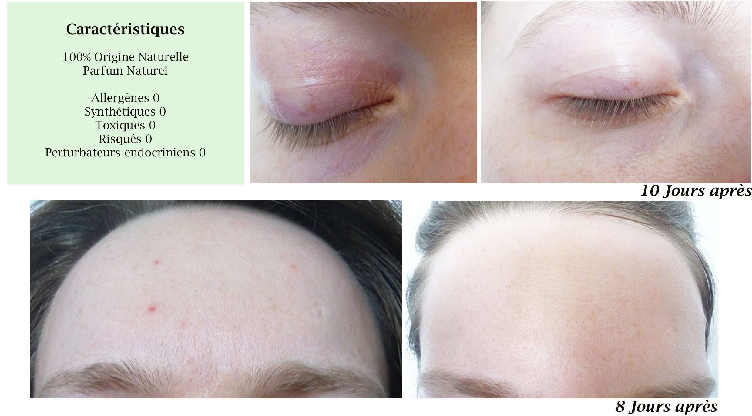 DROP - MERVEILLE DES LANDES ORGANIC - Sensitive Skin Care Complete Regeneration